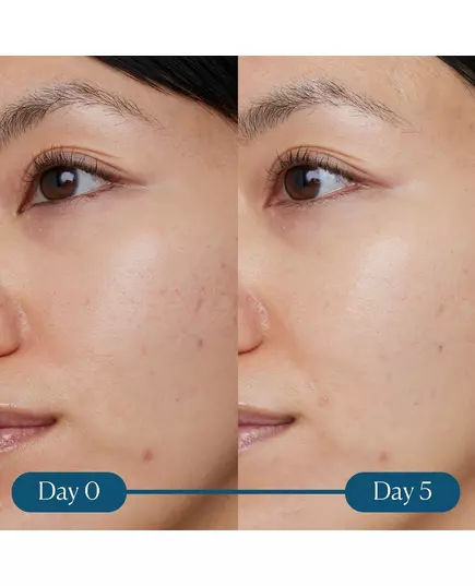 Elemis Dynamic Resurfacing Super-C Serum 30 ml, image 9